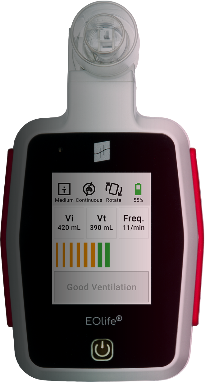 EOlife: The only Ventilation Feedback Device (VFD) to measure the volume of gas reaching the patient’s lungs (TIDAL VOLUME)